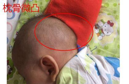 一、 额有伏犀骨：贵相的象征