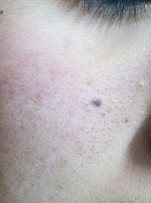 脸上长白毛是什么预兆，凶还是吉？