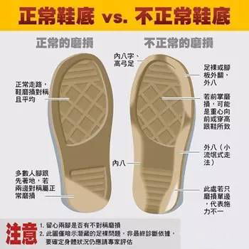 常见磨损模式及其临床意义