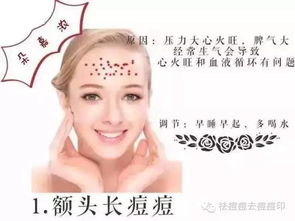 额头反复较长痘之成因与干预措施的系统性解析