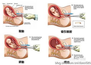1. 医疗档案保存制度概述