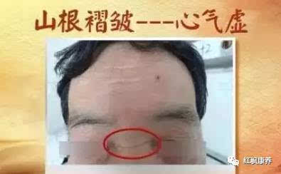 一、 青筋出现的生理与象征意义
