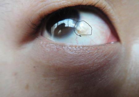 眼白多眼黑少的面相是否代表运势不佳或性格缺陷？