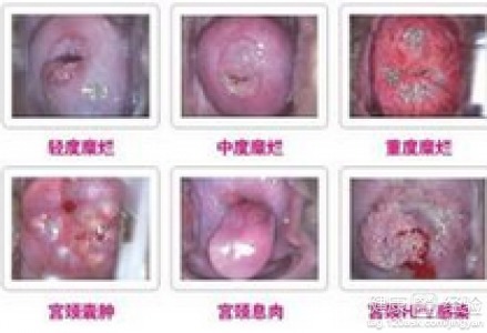 第四章：糜烂的“”——并非全部糜烂都意味着绝望