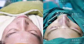 1) 消毒与无菌维护