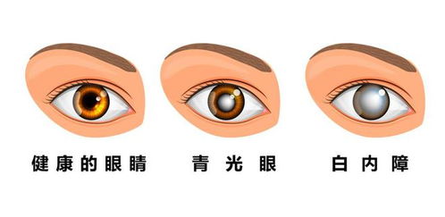 b) 黑白分明——瞳孔色泽比例对行为倾向的预测