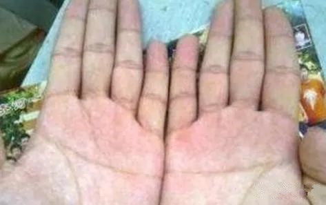 手指缝隙漏财的说法有科学依据吗？这代表什么命运？