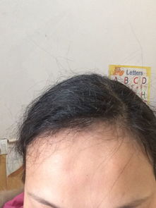 官禄宫青筋之象征意义