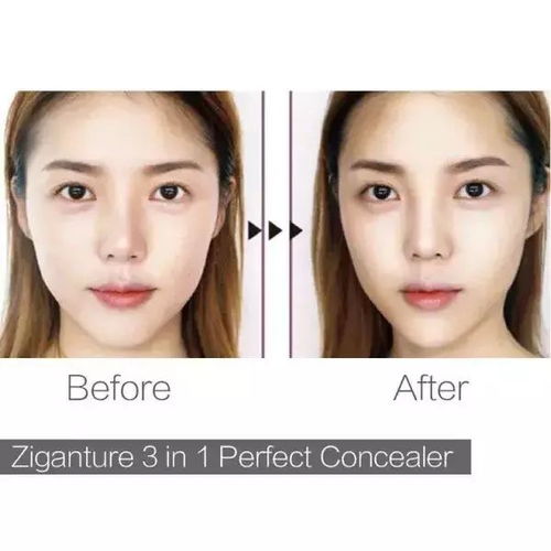 尖下巴（瓜子脸）——晚年运势潜在下降风险