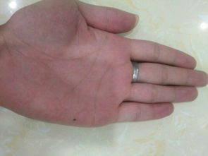 手相男手指竖纹多是什么原因？