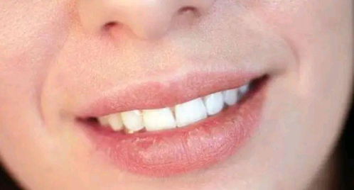 2.1 红润饱满者：健康活力与情感丰富