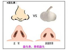 （二）加法策略：提升较高度并沉重塑结构
