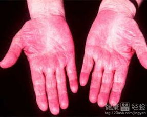 辣眼睛！孕妇梦见红辣椒竟有这么多奇葩说法