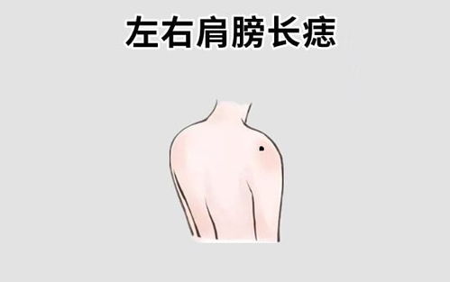 二、  奸门形态与婚姻运势的关联性分析