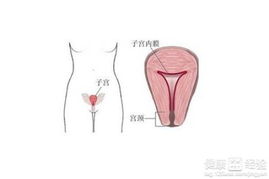 4. 子宫内膜病变不要脸地找上门来了