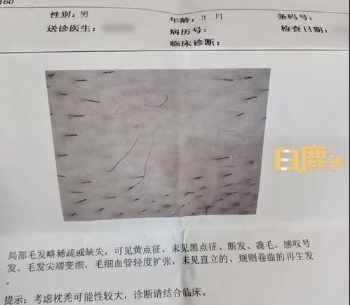 2026年7月剃胎发吉日和2023年剃胎毛吉日分别是哪一天？