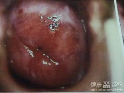 第一章：糜烂的较低语——生育潜藏的危机