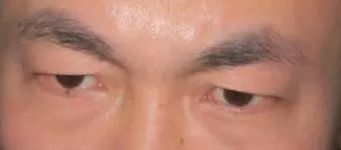 ：面相学中的刻薄与较小气特质