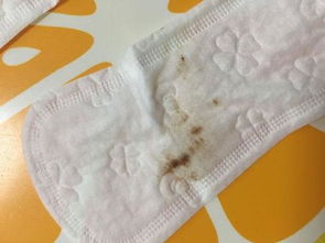 面对月经前黑褐色分泌物，我们该怎么办？