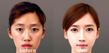 4. 双眼皮配合迷人眸子