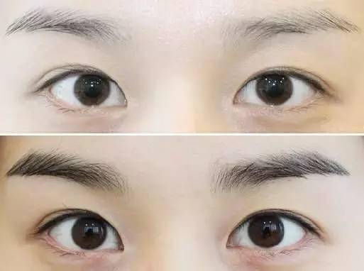 修剪方法及平安原则