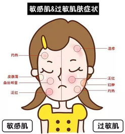 ：皮肤过敏的国学玄学阐释与饮食调理之道的宏观审视