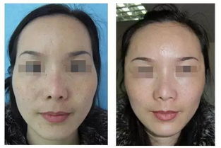 颧骨显著之成因及其在面相学中的象征意义