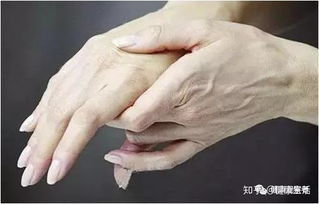 3. 脑血管病症诱发的意识障碍