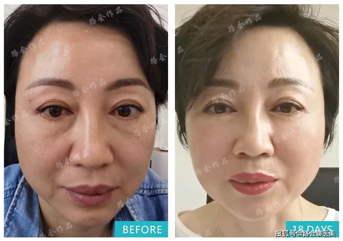 二、 鼻梁与颧骨的协同作用：地位、权力与个人的平衡