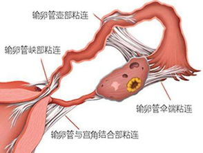 第三一部分：潜在危机 – 其他病症有可能潜伏其中