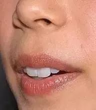 八字嘴命运上嘴唇薄如何改善命运？