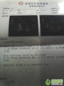如何根据出生日期准确查询宝宝的星座？