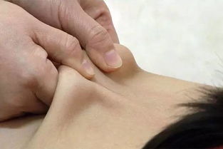 一、  阴阳脸的表象与初步认知