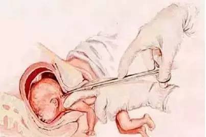 一、 堕胎婴灵超度仪式的理论依据与文化背景