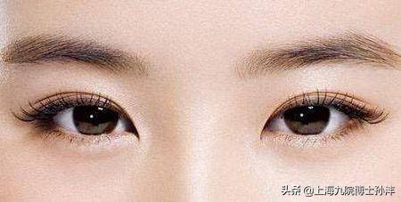 眼睛下方为何会出现深长八字纹，与眼内角成八字纹有关吗？