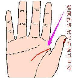 男人和女人手相相似，女人右手有黑痣，这样的手相改写为是：男人和女人手相相似，女人右手有黑痣，这样的手相好不好？
