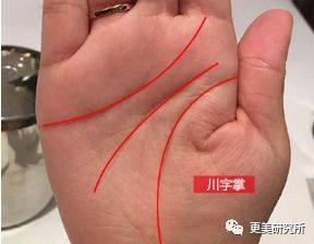 川字掌的形态学特征及其命运隐喻：关于生活富足与子女缘分稀薄的深度解析