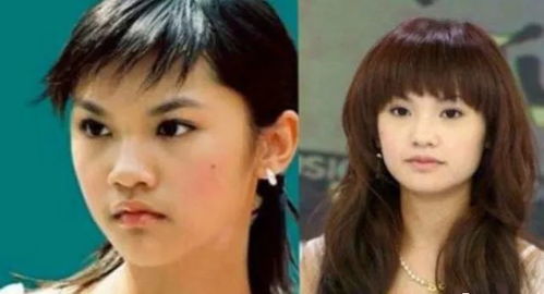 二、  先天禀赋与后天创伤：结构性偏斜的二元归因