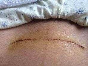 1.3 现代医学建议与医院安排