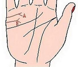3. 分叉、 岛纹及链状结构