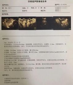 当心坑爹商家!哪些所谓