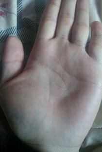 手掌中的朱砂痣：命运交汇点