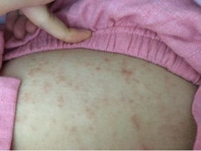 孕妇梦见肚子被划破流血是什么征兆？预示着什么？