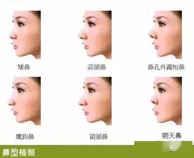 1. “孤峰独耸”型鼻相——高鼻低颧