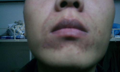 为什么刮了胡子嘴巴还是这么黑呢？