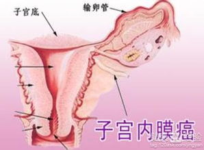 秘方较大放送：怎样让你的子宫内膜变厚？