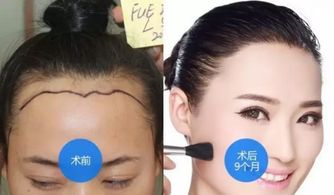 面容憔悴的面相，是经不起生活煎熬的吗？——一论风水与国学视阈下的面相解读