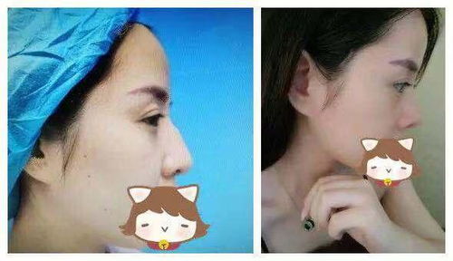 1. 形体特征之细部描绘