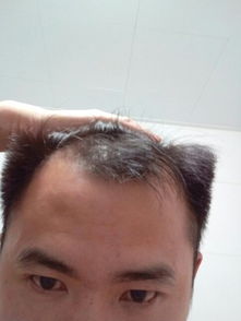 额头两侧有两条沟的风水影响大吗？额头风水图片大全有哪些？