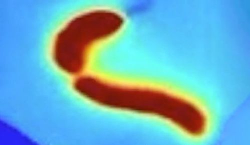 那个谁谁谁！藤条缠死你的秘密大曝光